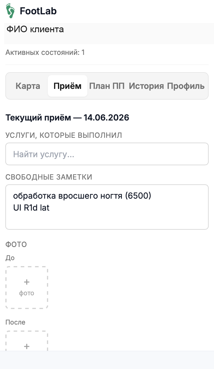 Приём и фото
